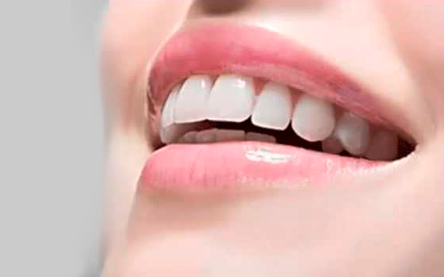 cariilas-dentales
